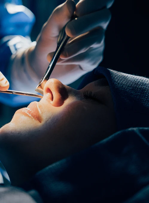 A close-up, dramatic profile view of a patient's face during a nasal procedure, illuminated by a bright surgical light while a gloved hand uses a medical instrument near the bridge of the nose. - Nose in Los Angeles, CA