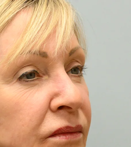 2-PO 3mo R Quarter-cropped