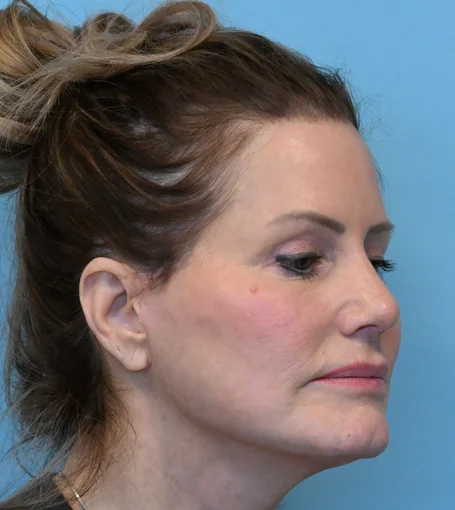 PO 6wks R Quarter-cropped