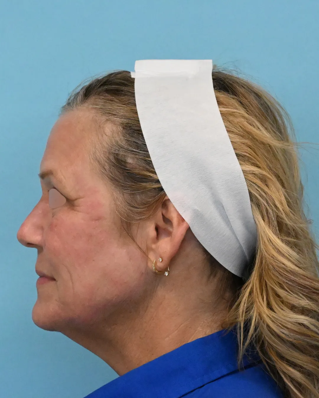 after left side